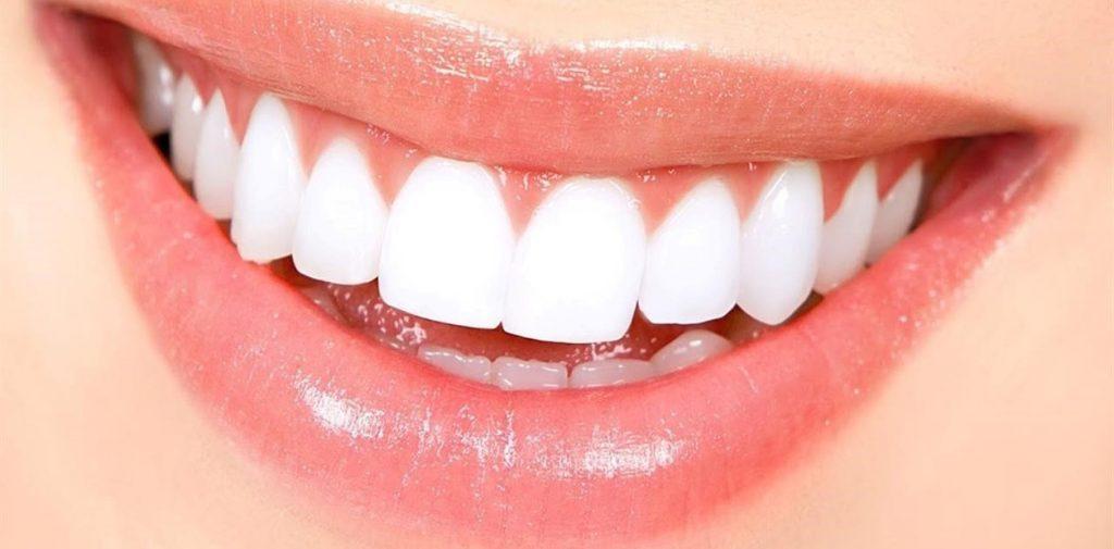وصفات تبييض الأسنان مع خلطات طبيعية للتخلص من أصفرار الاسنان بطرق سهلة