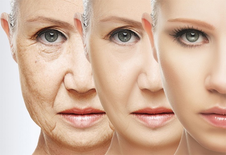 علاج التجاعيد Wrinkles بأفضل الطرق الطبيعية و الطبية فى أسرع وقت
