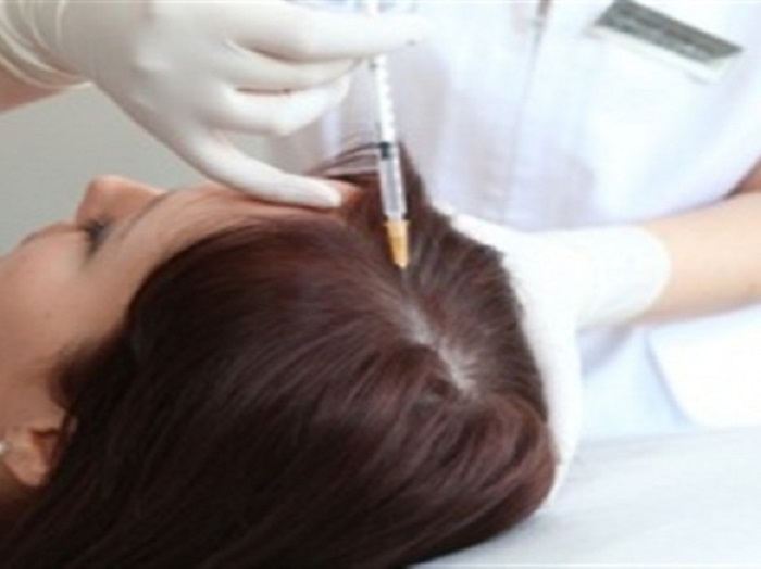 علاج مرض الثعلبة Alopecia بالطرق الطبية